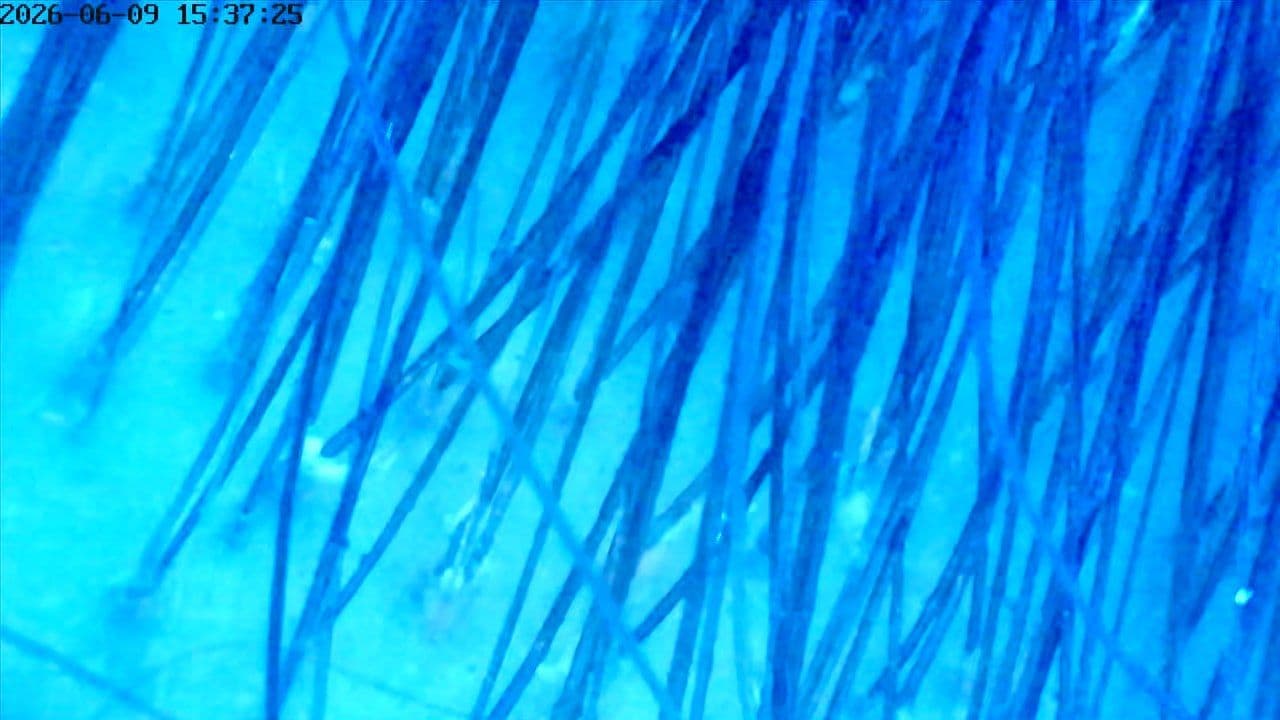 UV scalp scan