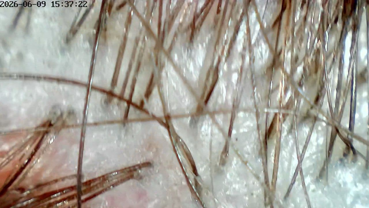 White-light scalp scan