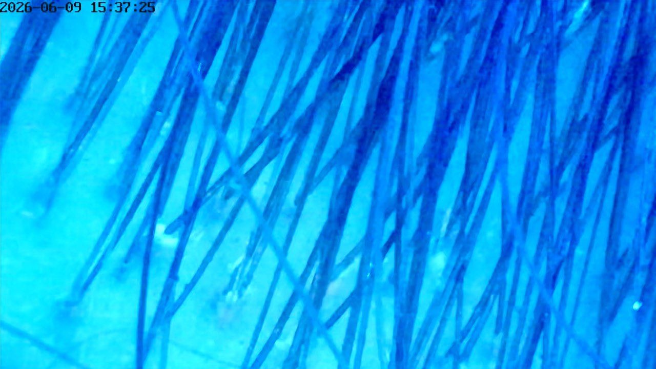 Microscope image of scalp and hair under UV light
